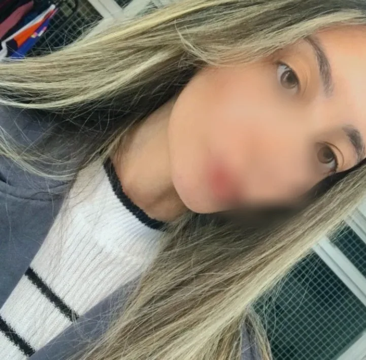Rebecca, 20 anni
